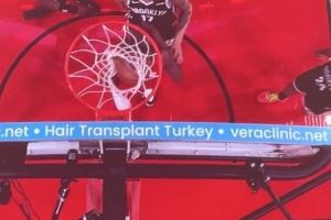 问啥詹姆斯！NBA篮板上沿有土耳其植发公司广告 手动@杰伦-布朗